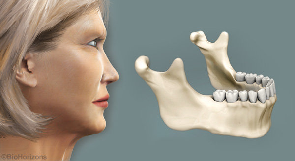 Facial appearance with healthy teeth and bones.